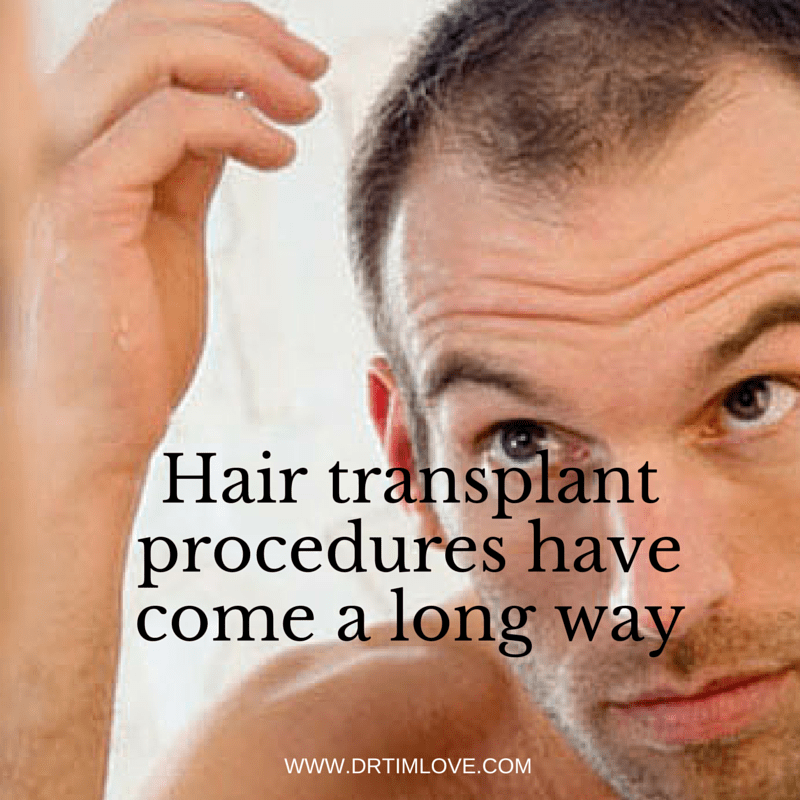 Hair Transplant Procedures Have Come a Long Way