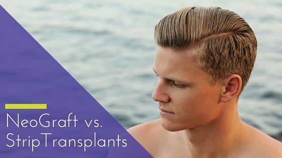 NeoGraft vs. Strip Method: Which Hair Transplant Method is Better?