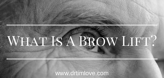 What is a Brow Lift and Why Should I Get One?
