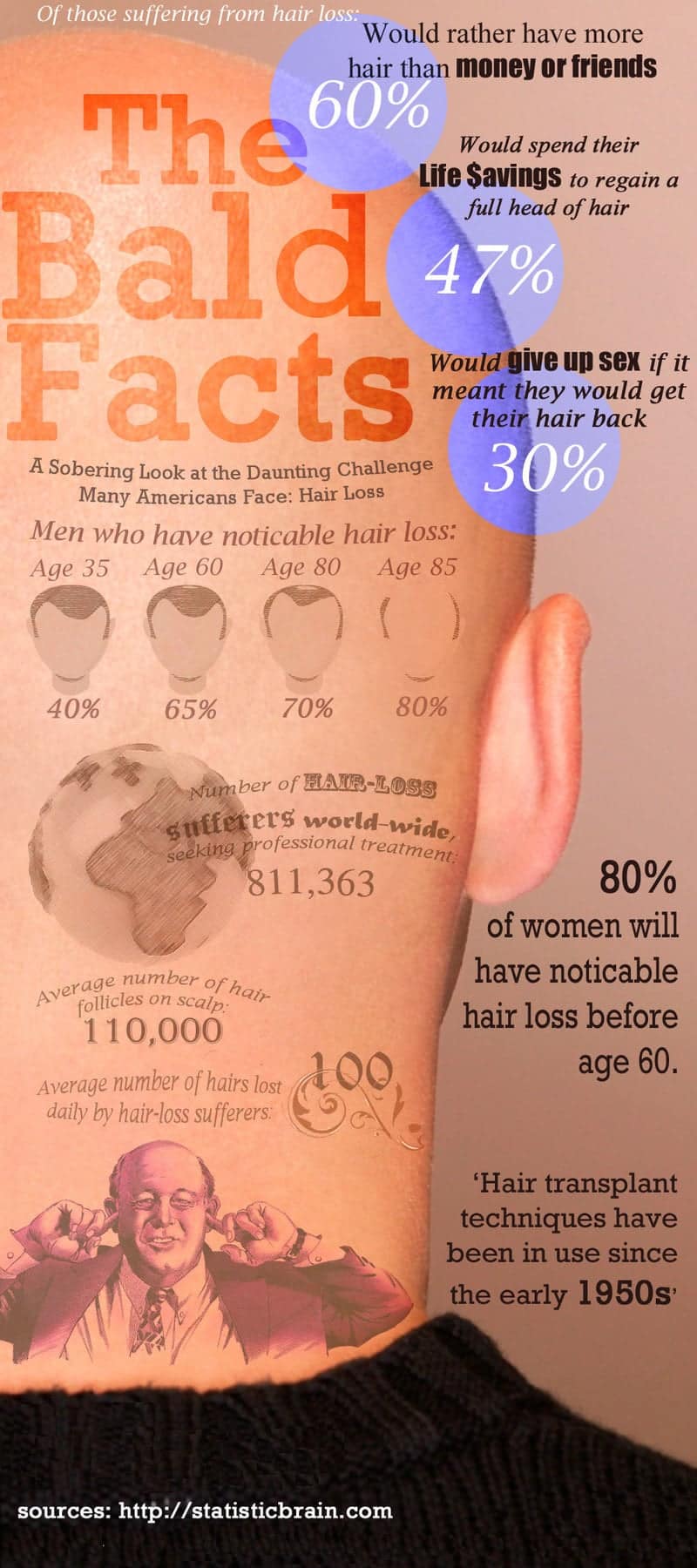 Infographic with data about hair loss in men