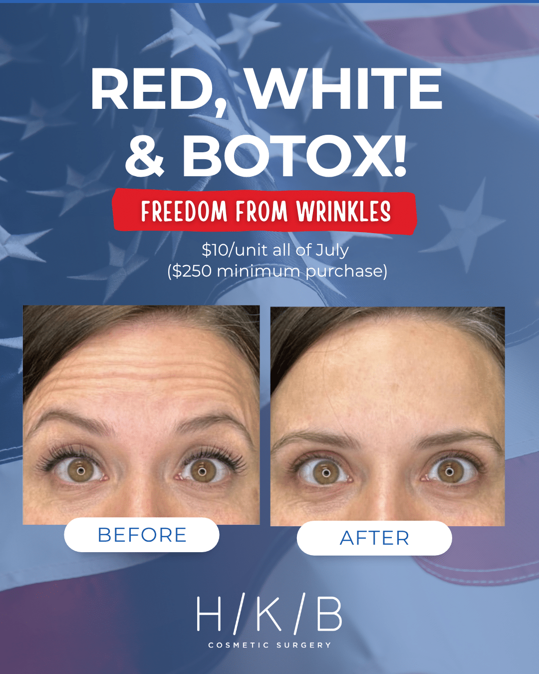 HKB Red White Botox